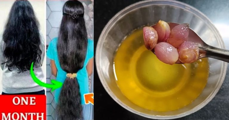 Small Onion Hair Oil for hair loss